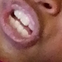 แอด