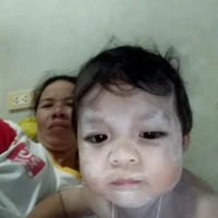 แอด
