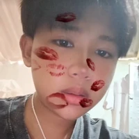คิม