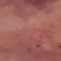 ?????