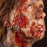 injured man
