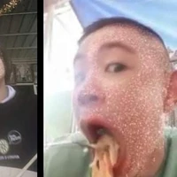 ตุ่น