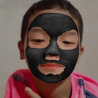 ก้อน