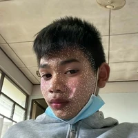 แอดสุดสวย