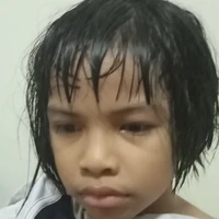 แอด
