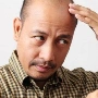 Pak botak Dodi