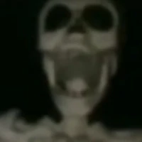 cadáver