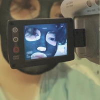 แอด