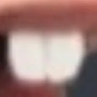 ฟันสวยเองจร้า