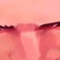 แอด