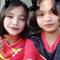 แอด