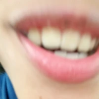 เพื่อนแอด