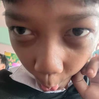 คุรคิมอุ้ยสะดุดล้ม