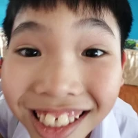 โกโร่