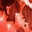 *****00